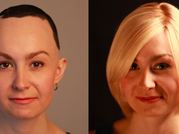 before and after