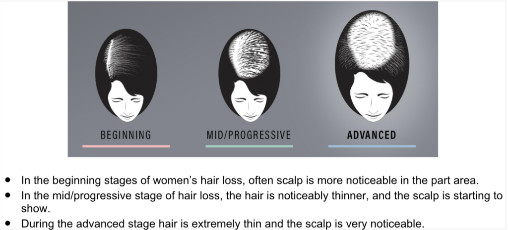 Hair toppers before and after women