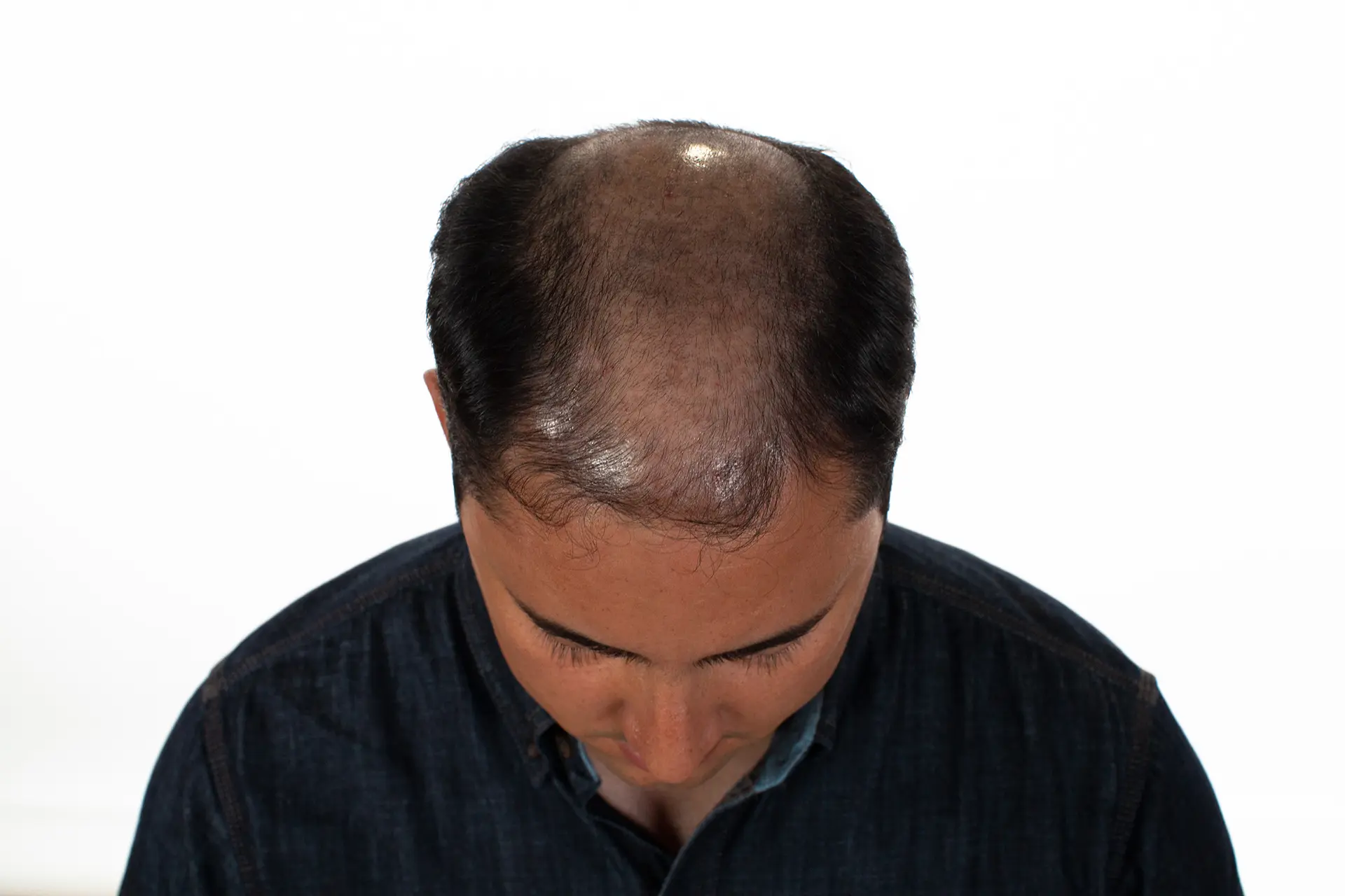 Antonio Before