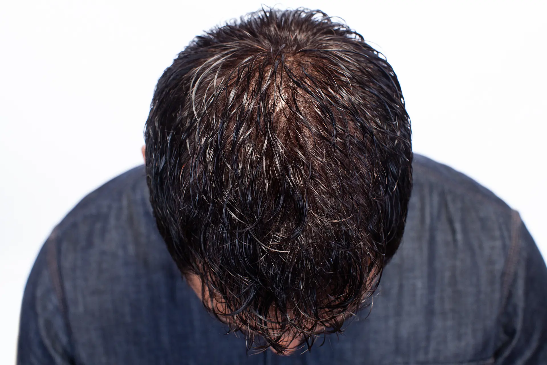 Antonio After Top Of Head